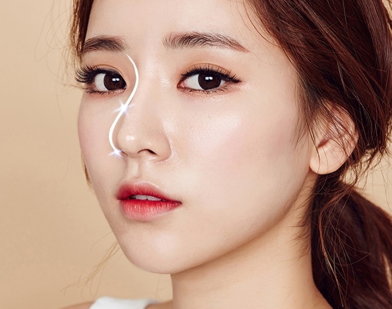 Nâng mũi Hàn Quốc cho sống mũi mềm mại tự nhiên