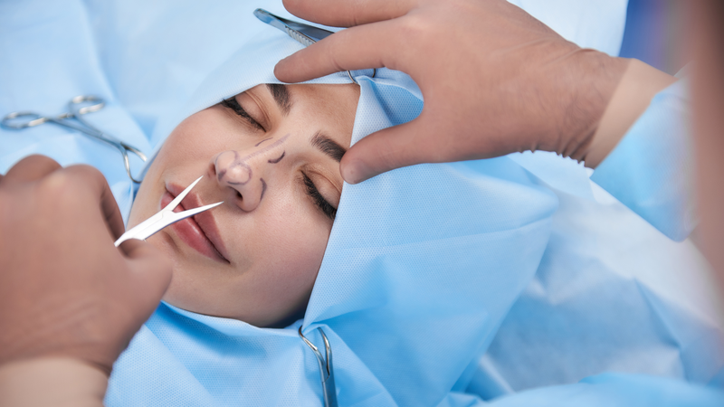 nang-mui-high-line-tieu-chuan-uu-diem-quy-trinh-va-nhung-dieu-can-luu-y