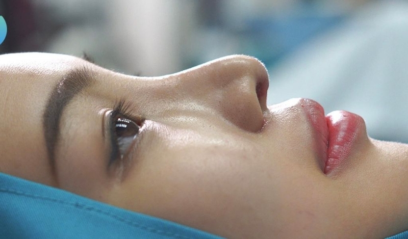 Nâng mũi siêu cấu trúc là gì? Thời gian duy trì bao lâu? 2