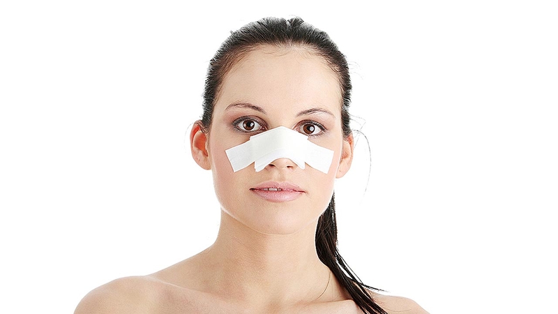 Nâng mũi sụn sườn là gì? Những lầm tưởng mà bạn nên biết 3