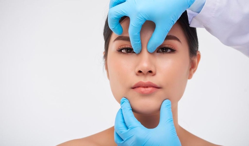 Nâng mũi tháo nẹp sớm có sao không? Sau bao lâu có thể tháo băng nẹp? 2