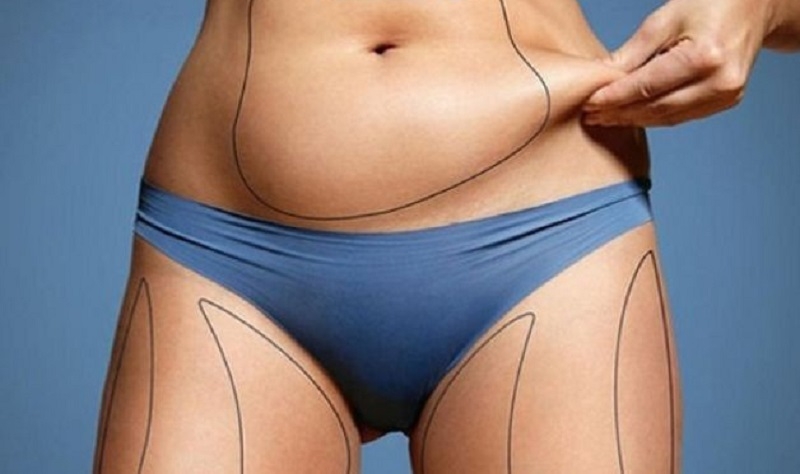 Phương pháp nâng ngực bằng mỡ tự thân