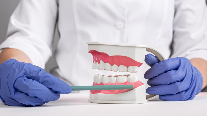 Nang thân răng: Nguyên nhân, triệu chứng và hướng điều trị hiệu quả 2