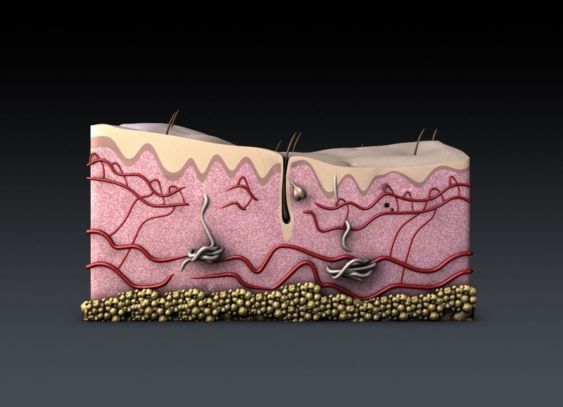 Nang tóc là gì? Nguyên nhân nang tóc chết và cách khắc phục 2