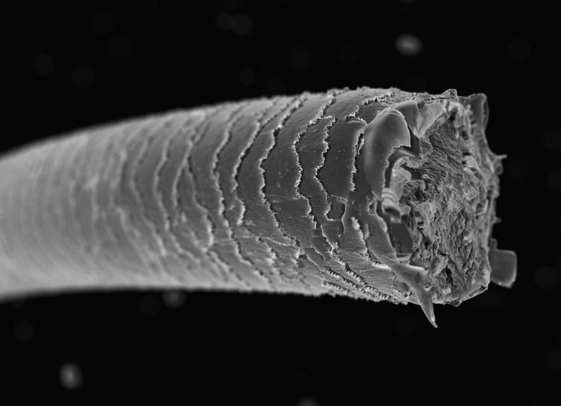 Nang tóc là gì? Nguyên nhân nang tóc chết và cách khắc phục 3