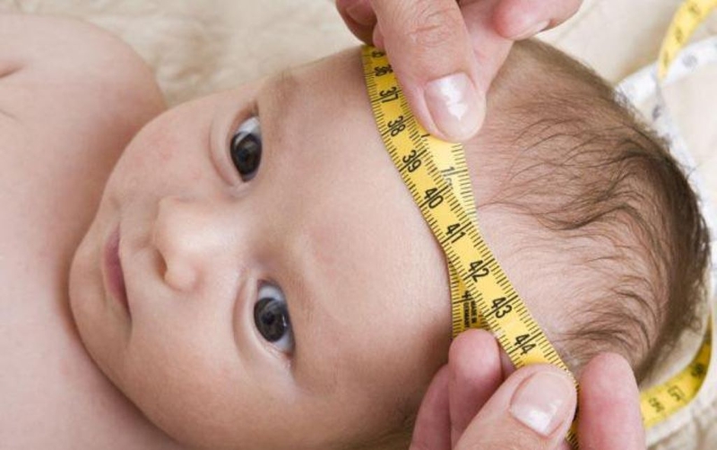 Não úng thủy là gì? Nhận biết sớm dấu hiệu não úng thủy ở trẻ em 3