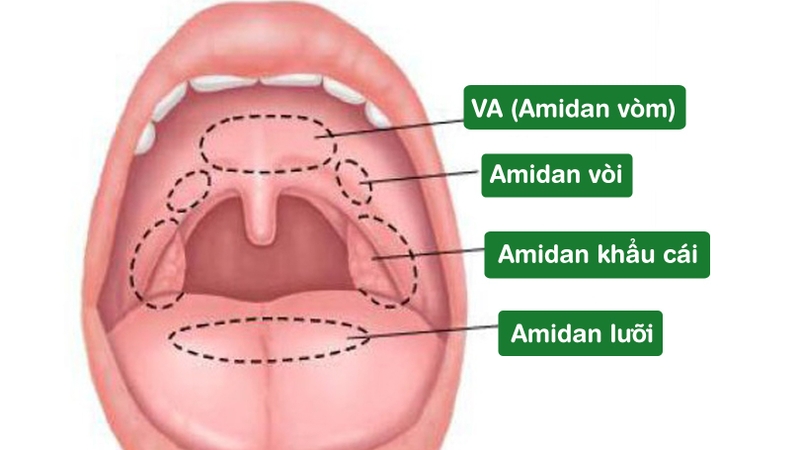 Nạo VA và cắt Amidan như thế nào? 2