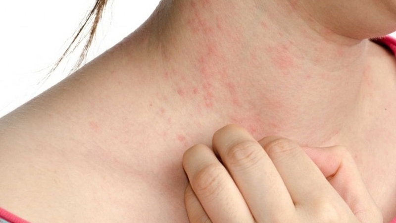 Natri Caseinate là gì và tại sao nó được sử dụng trong thực phẩm? 4