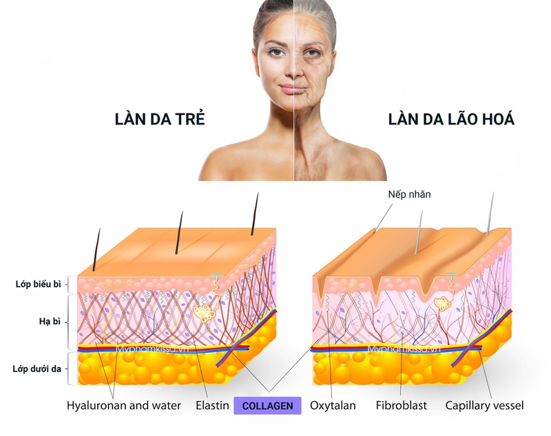 Nên bổ sung collagen chống lão hóa khi nào?1