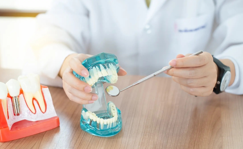 Nên bọc răng sứ kim loại hay Titan? Lưu ý cần biết - 2