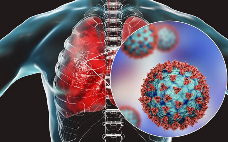 Nên chụp CT phổi vào lúc nào? Chụp CT phổi giá bao nhiêu? 1