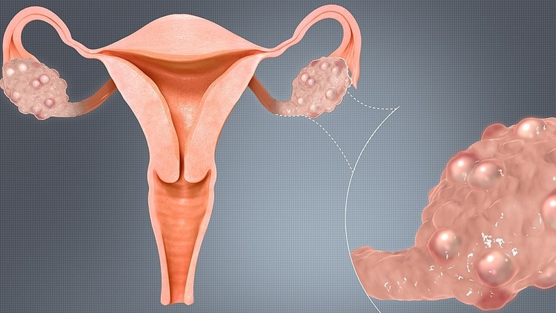 Nên đi khám hiếm muộn vào thời điểm nào? 2