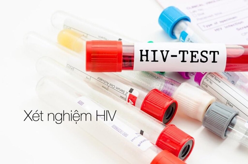 Nên đi xét nghiệm HIV khi nào? Quy trình thực hiện xét nghiệm HIV 2