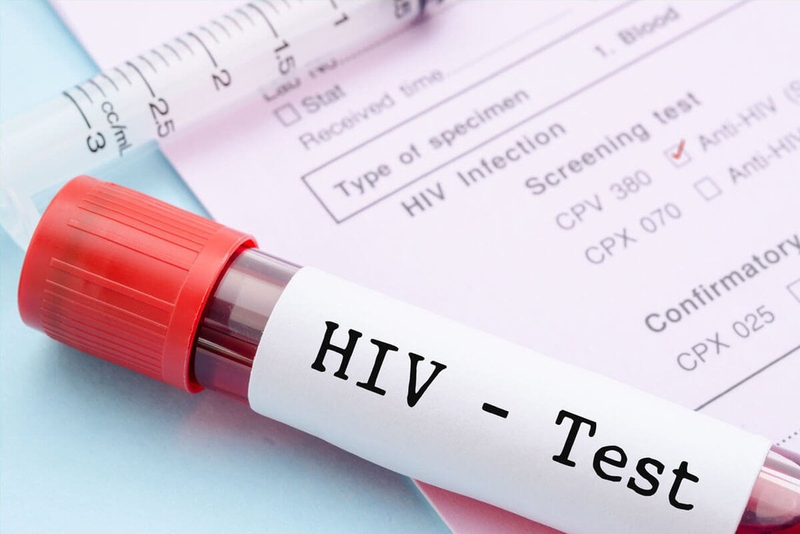 Nên đi xét nghiệm HIV khi nào? Quy trình thực hiện xét nghiệm HIV 3