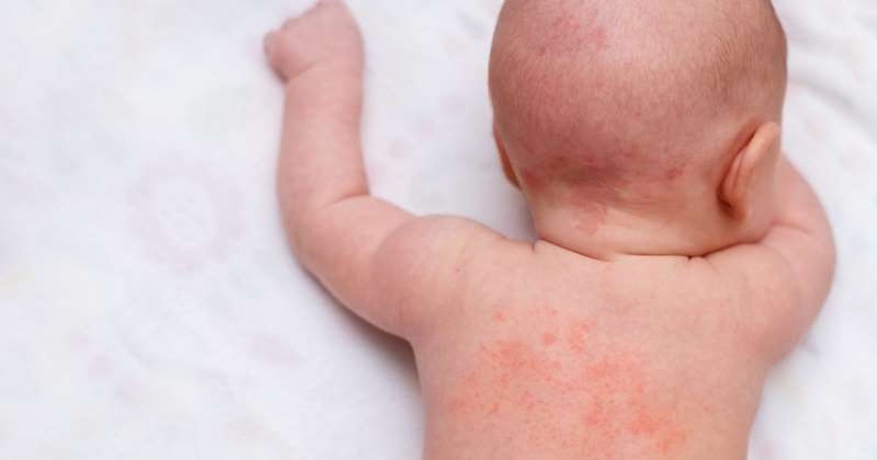 Nên hay không áp dụng cách tắm nước dừa cho trẻ sơ sinh?