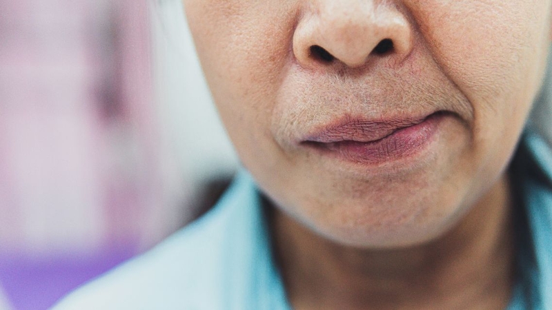 Nên làm gì khi có dấu hiệu đột quỵ? Hướng dẫn xử trí khẩn cấp 2