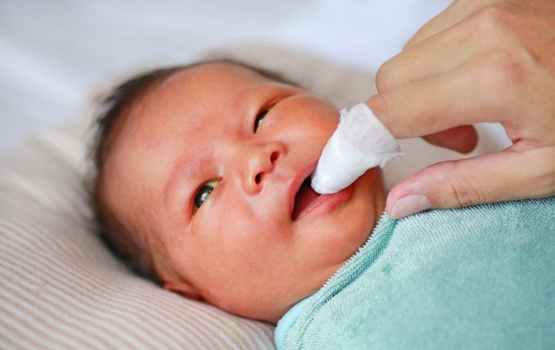 Nên làm gì khi nấm lưỡi ở trẻ 2 tháng tuổi? Hướng dẫn cách rơ lưỡi 3