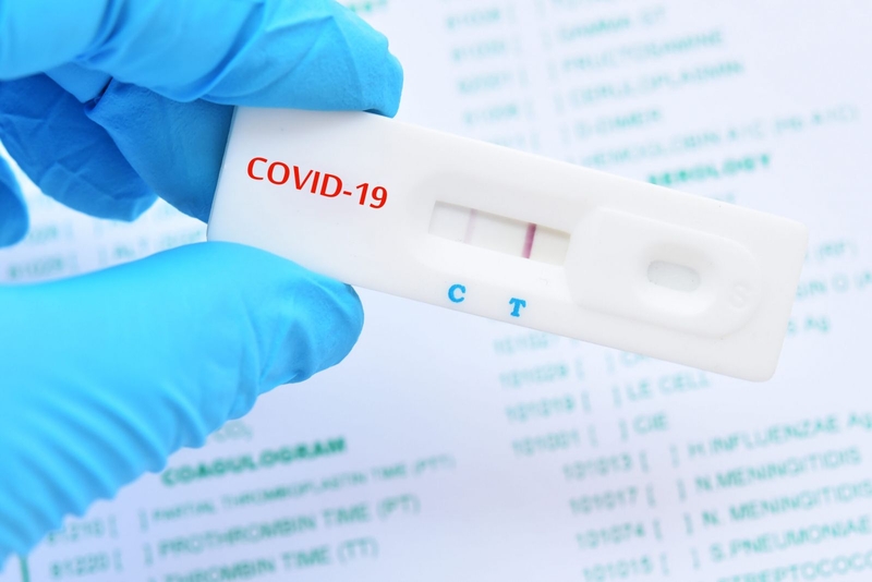 Dịch bệnh Covid 19 bùng phát mạnh mẽ nên vấn đề nên làm test covid PCR ở đâu được rất nhiều người quan tâm