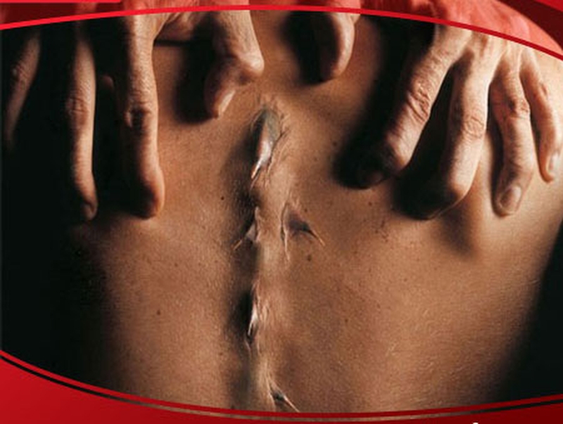 nen-luu-y-voi-chung-dau-lung-gai-cot-song