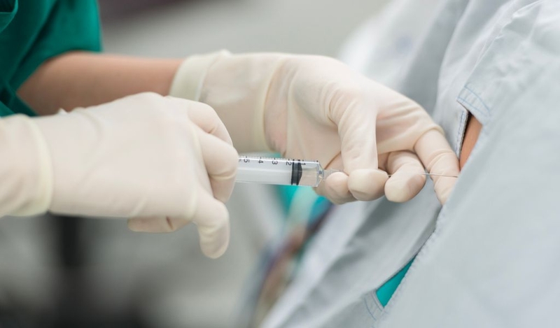 Nên nâng mũi gây tê hay mê? Ưu, nhược điểm của gây tê và gây mê 1