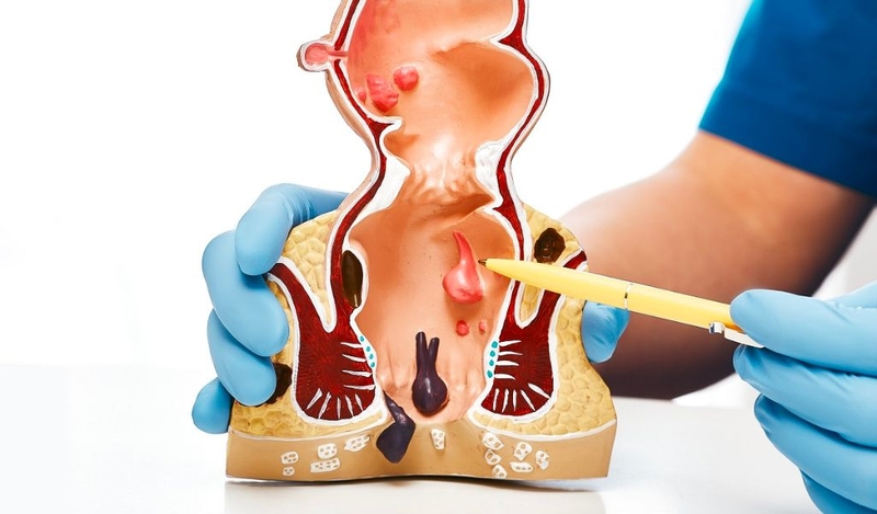 Nên uống bột diếp cá vào lúc nào để đạt hiệu quả tốt nhất? 1