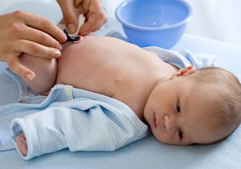 Nên vệ sinh rốn cho trẻ sơ sinh bằng gì ? 3