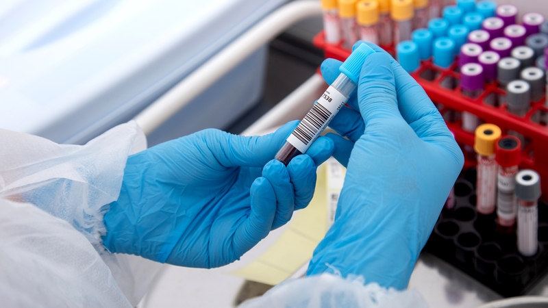 Nên xét nghiệm máu ở đâu? Tiêu chí lựa chọn nơi xét nghiệm uy tín 1