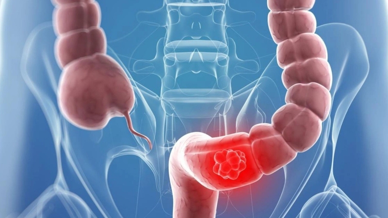 Nếu lỡ nuốt giấy thì giấy có tiêu hóa được không? -2