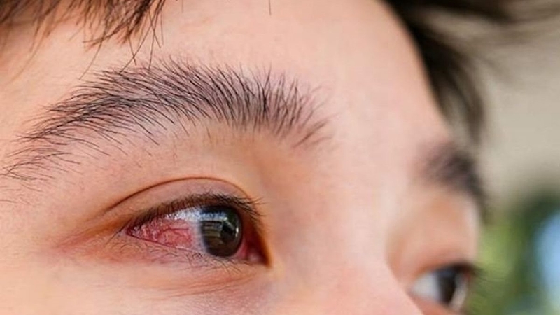 Ngâm dâu tằm bị mốc: Hướng dẫn ngâm dâu tằm đúng cách 2