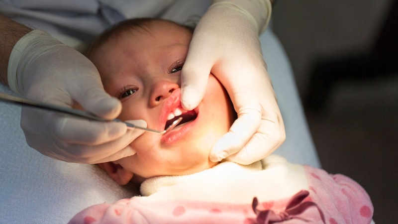 Sử dụng ti giả đúng cách giúp giảm nguy cơ sai lệch răng miệng