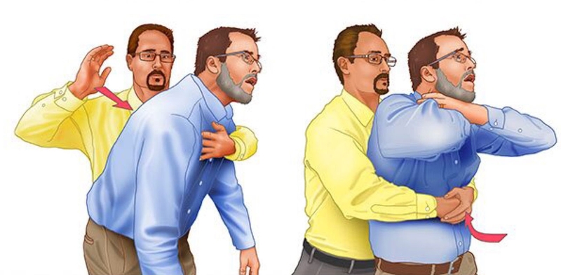 Nghẹt thở: Cách nhận biết và sơ cứu kịp thời-3