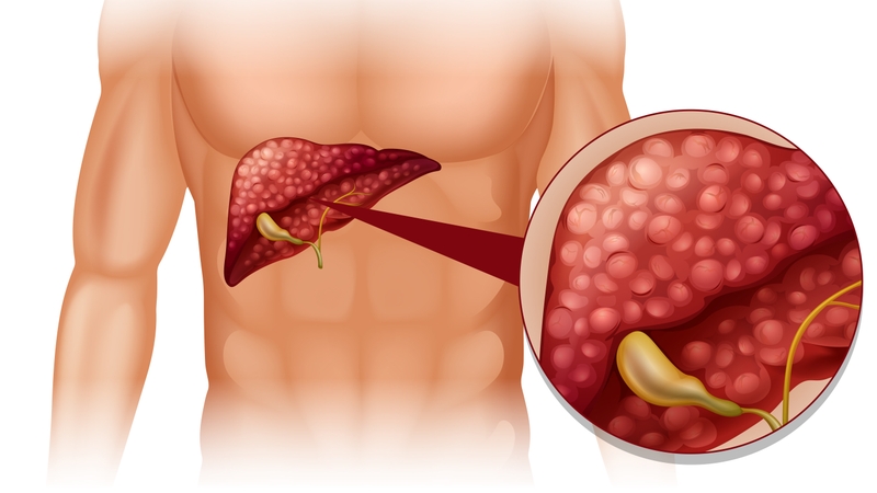 Vị trí túi mật trong cơ thể