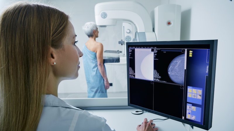 Chụp nhũ ảnh không chỉ giúp phát hiện ung thư vú mà còn cung cấp thông tin quan trọng về sức khỏe tim mạch