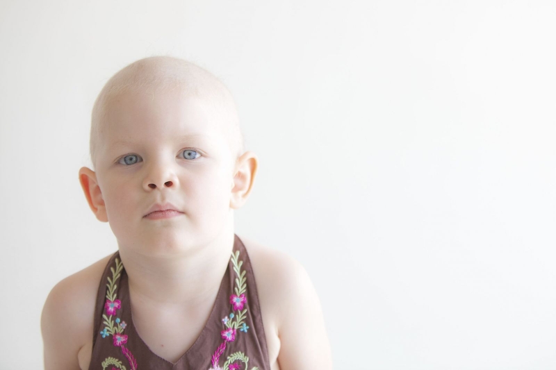 Nghiên cứu mới nhất về bệnh u lympho không Hodgkin ở trẻ em 3