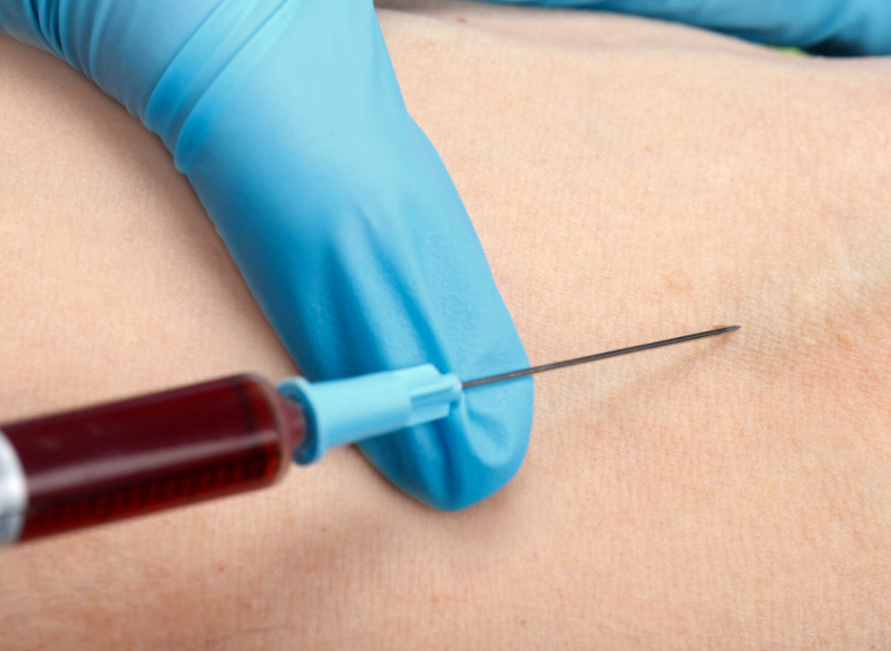 Nghiện ma túy là gì? Tất cả thông tin cần biết về bệnh nghiện ma túy 3