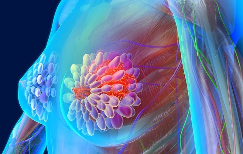 Nghiện rượu và nguy cơ ung thư vú 3