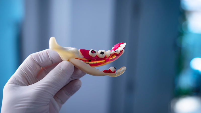 Nghiện soda: Triệu chứng và hậu quả khôn lường 4