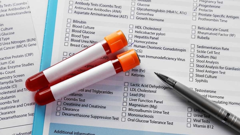 Nghiệm pháp co cục máu là gì? Các bước tiến hành co cục máu 4