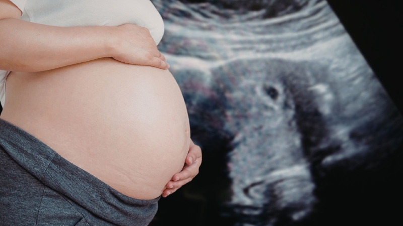 Khi mẹ mang thai đôi hoặc nhiều hơn, diện tích bên trong tử cung trở nên chật hẹp