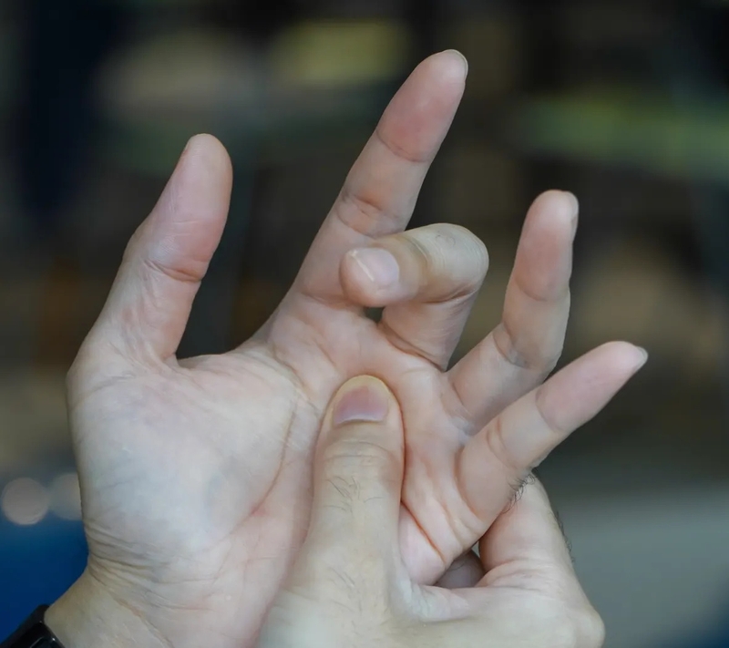 Ngón tay giữa bên trái không bật lên có nguy hiểm không? 2