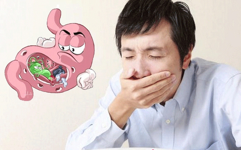 Bệnh trào ngược dạ dày thực quản dẫn đến viêm loét thực quản