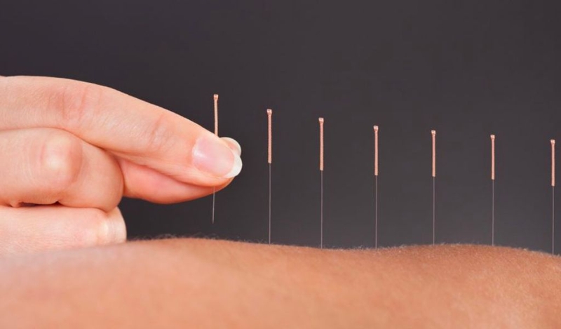 Ngủ dậy đau mỏi khắp người là do đâu và cách khắc phục như thế nào? 3