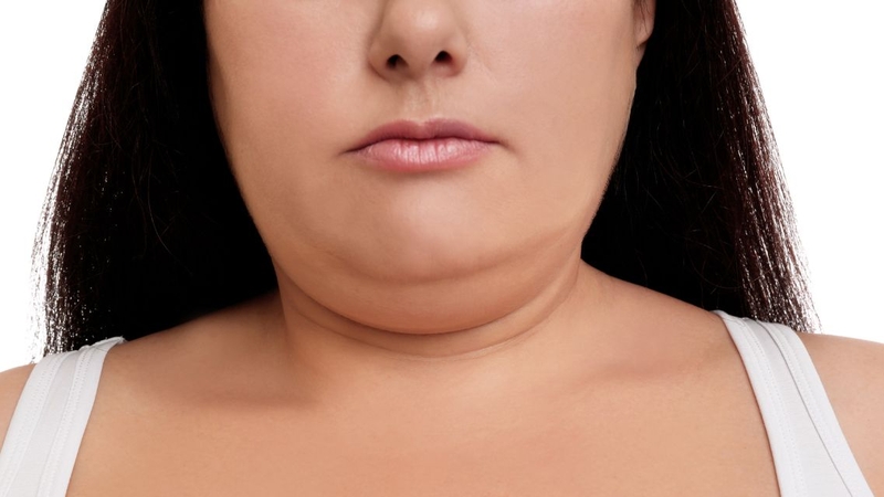 Nhiều người muốn biết&nbsp;ngủ nhiều có mập mặt không