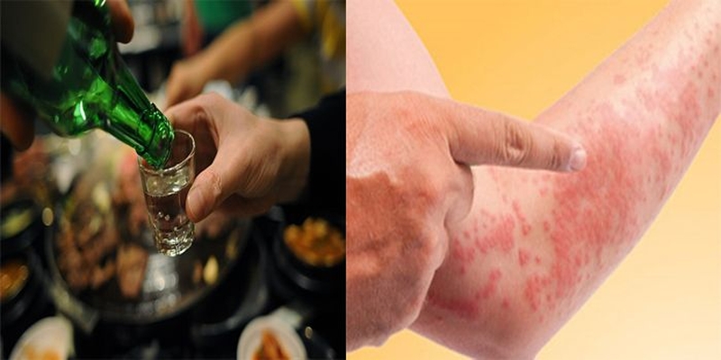 tai-sao-uong-ruou-bia-bi-do-khap-nguoi-cach-khac-phuc-nhu-the-nao