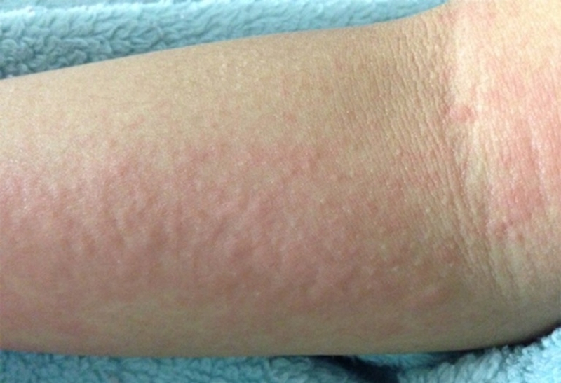 tai-sao-uong-ruou-bia-bi-do-khap-nguoi-cach-khac-phuc-nhu-the-nao-1