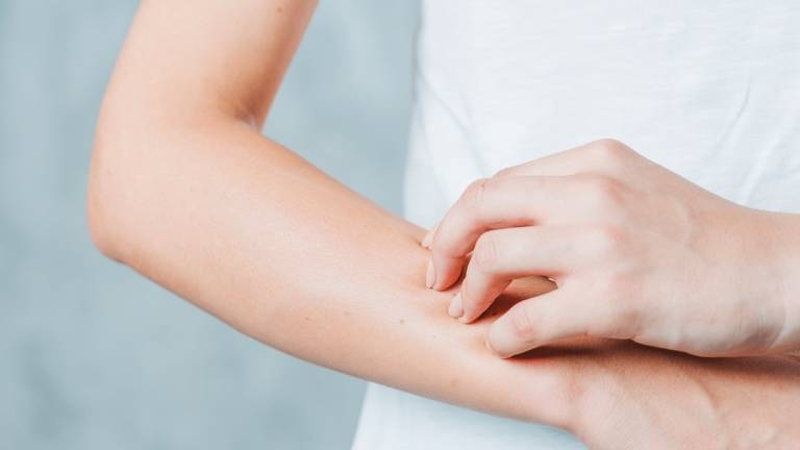 bi-ngua-nhu-kien-can-khap-nguoi-la-bieu-hien-cua-benh-gi-1