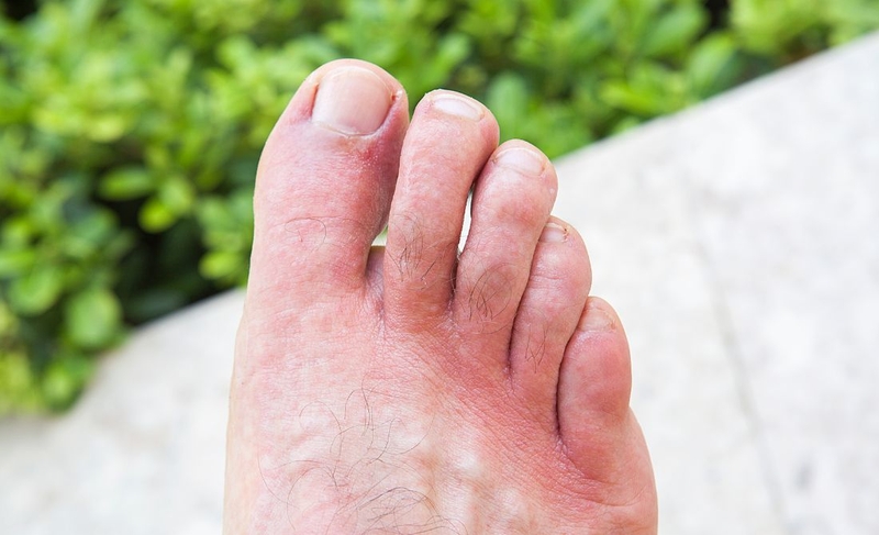 Những nguyên nhân gây ngứa chân và cách khắc phục hiệu quả 2