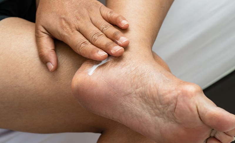 Những nguyên nhân gây ngứa chân và cách khắc phục hiệu quả 4