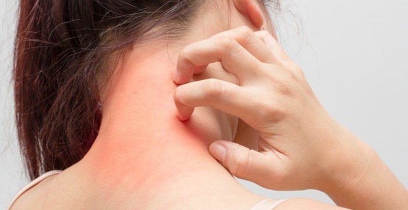 Ngứa da bất thường: Lời cảnh báo của 4 loại bệnh 1