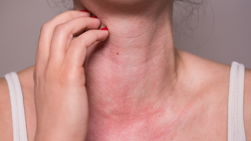 Khi thời tiết hanh khô hoặc thay đổi đột ngột, da có thể mất độ ẩm tự nhiên, dẫn đến khô, căng và ngứa